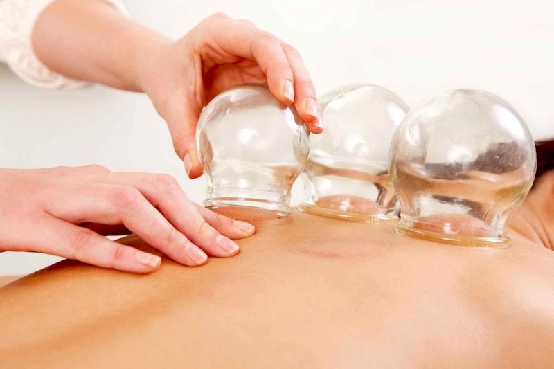 Cupping therapy near me