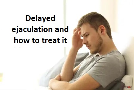 Delayed ejaculation and how to treat it